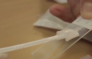 Tízezer nő kap meghívót méhnyakszűrésre