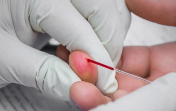 Tünet nélkül is jelen lehet: ezért fontos a rendszeres PSA-vizsgálat