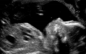 Méhen belül gyakorolják a sírást a babák