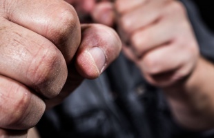 Verekedés a Baross Gábor utcában - betörték egy fiatal orrát