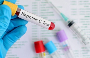 Ingyenes hepatitis C szűrés Kaposváron