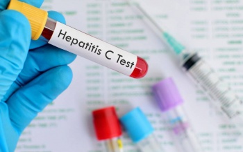 Ingyenes hepatitis C szűrés Kaposváron