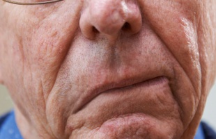 Ma van a stroke világnapja – életet menthet a gyors felismerés