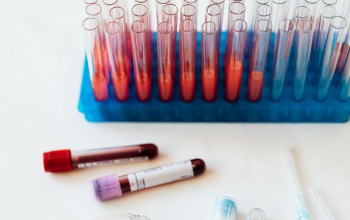 Hat helyszínen nyolc alkalommal lesz véradás jövő héten