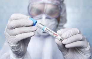 Ez a különbség az egyes tesztek között